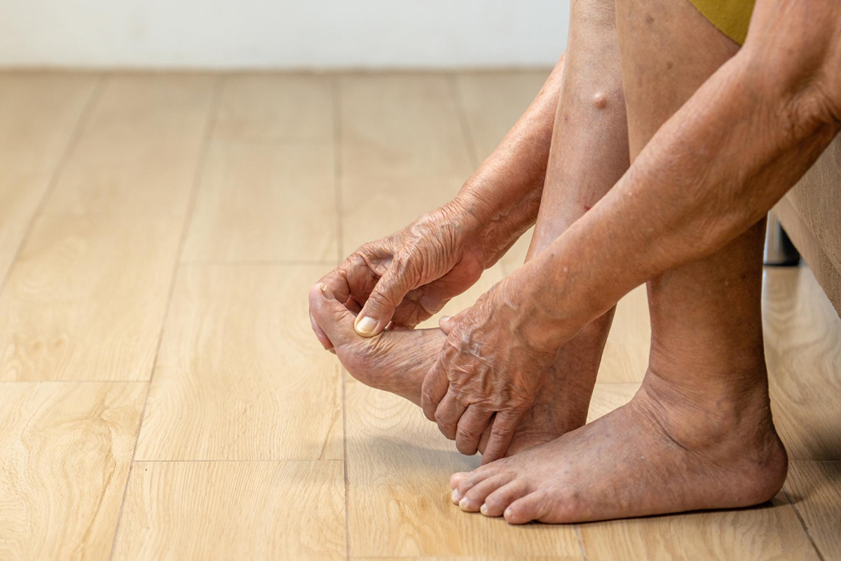How Physical Therapy Can Help Treat Plantar Fasciitis