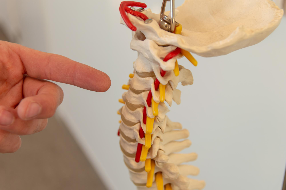 Understanding Radicular Syndrome